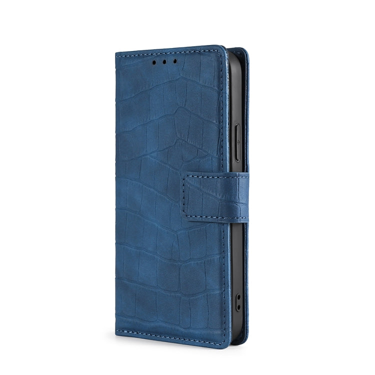 Funda de Cuero para Huawei Nova 10 Se Skin Feel Cocodrilo con Cierre Magnético (Azul)